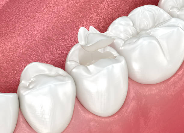 Oral Surgery in Cohoes, NY